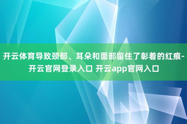 开云体育导致颈部、耳朵和面部留住了彰着的红痕-开云官网登录入口 开云app官网入口